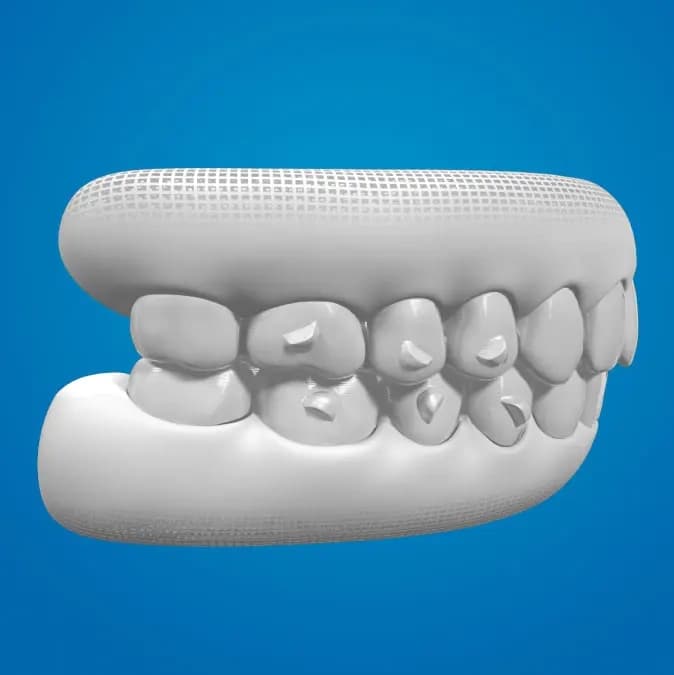 SmartForce attachments on teeth on blue background