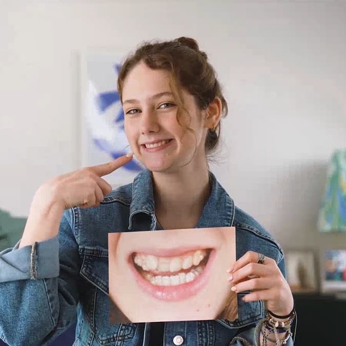 Girl smiling and pointing at her teeth after Invisalign® treatment and holding the photo of her teeth before Invisalign treatment