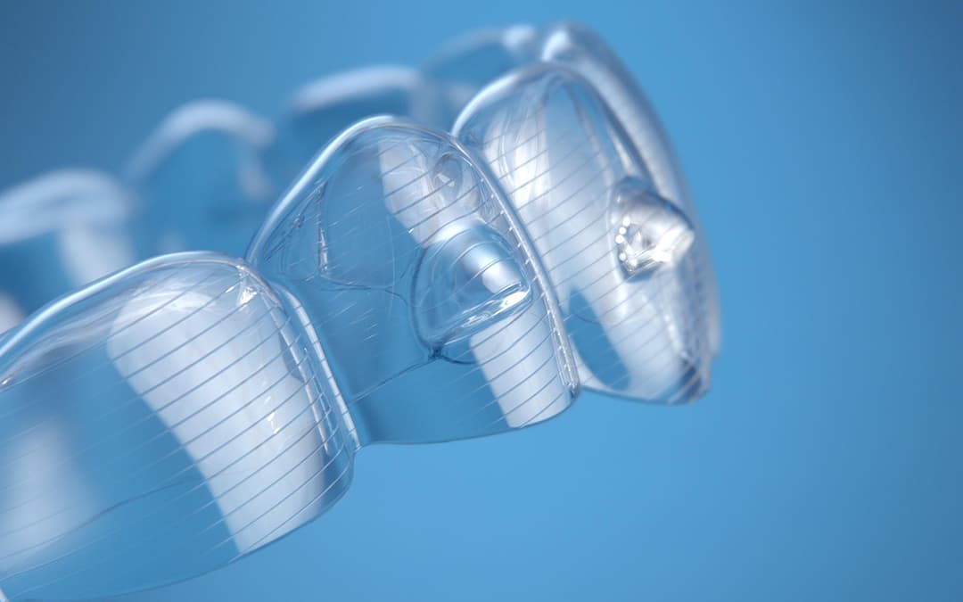 Invisalign SmartForce™ Attachments | Invisalign